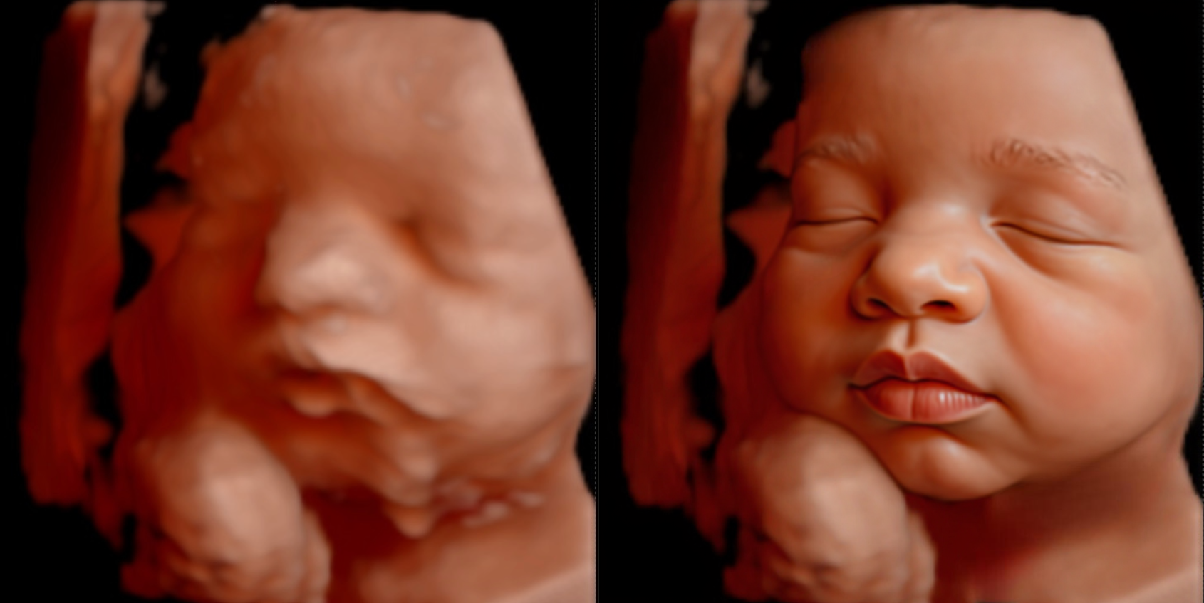 Hyper-Realistic Baby Image